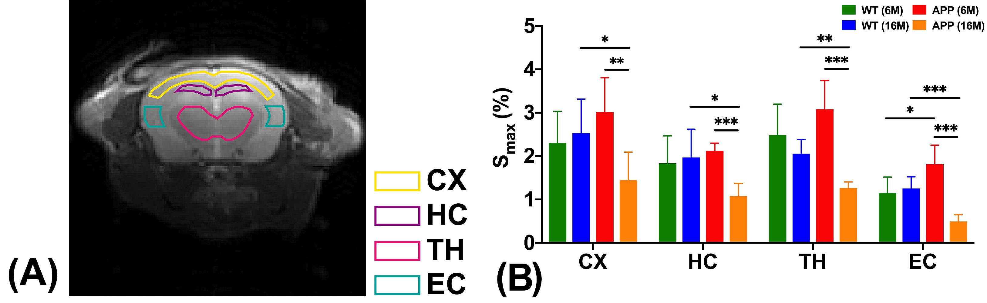 Regional MRI results for parenchyma